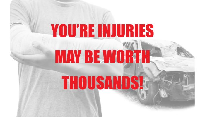 how much compensation do you get for brain injury 01